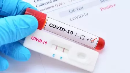 Testele de COVID care nu vor fi raportate niciodată. Mii de români le folosesc în umbră